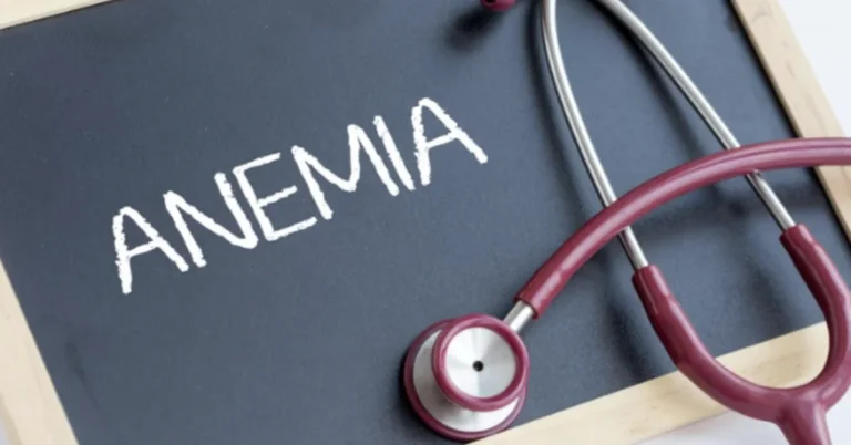 Anemia após cirurgia bariátrica como evitar